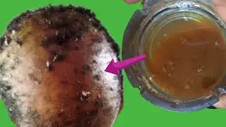 They don't tell you about this Fastest Indian Hair Growth Secret, 2 ingredients bye to hair loss