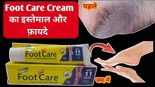 Foot Care Cream Uses In Hindi | Foot Care Cream For Cracked Heel | फुट केयर क्रीम का क्या उपयोग है ?