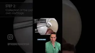 Dr. Porter Explains MACI Procedure
