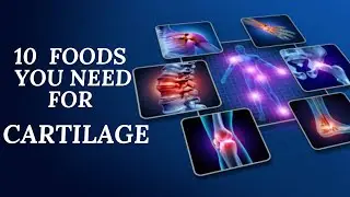 10 Nutritious Foods For Rebuilding Cartilage & Promoting Healthy Joints