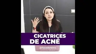 #armonizacionfacial  CICATRICES DE #acne