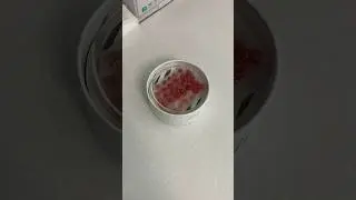 NeoGraft FUE Hair Transplant | Kalos Hair Restoration | Hair Loss Solutions | Minimally Invasive