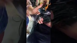 #Harshda #HairFallTreatment