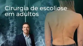 Cirurgia de escoliose em adultos