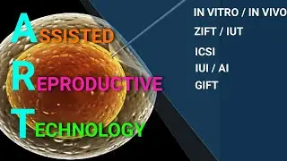 Assisted Reproductive Technologies (ART) | EMBRYO TRANSFER | ZIFT | IN VITRO | IN VIVO | IUI | IVF