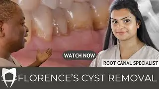 Removal of cyst & the treatment of widespread gum disease