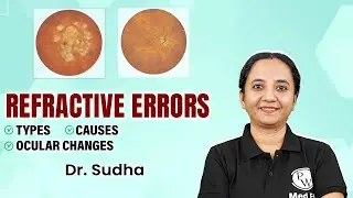 Refractive Errors | Ophthalmology | Ophthalmology Simplified with Dr. Sudha | PW MedEd
