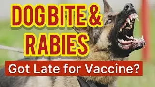 Anti-Rabies Vaccine: What to do  if You Get Late for Anti-Rabies Vaccination?