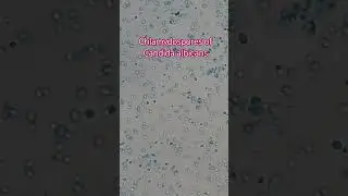 Chlamydospores of Candida albicans #shorts #science