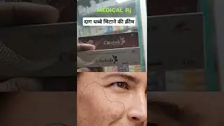 Clinfab cream | चेहरे के दाग धब्बे मिटाने की क्रीम |  क्लिनफेब क्रीम  | Clinfeb cream #faceglow