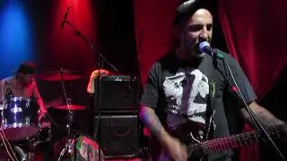 cirrosis