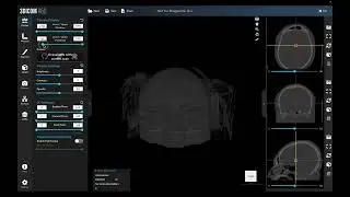 How to open DICOM files on MacOS with 3Dicom