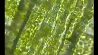 Egeria Densa al Microscopio