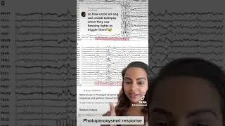 Photoparoxysmal response