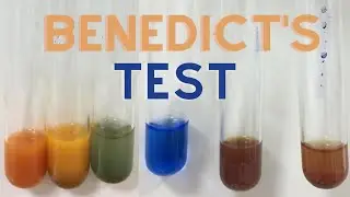 Analysis of Polysaccharides by Benedict's Test