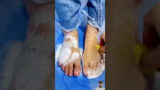 #feet #beauty #skincare #nails #suntan #cute #foryou #greenscreen #trendingshorts #viralvideo #1k