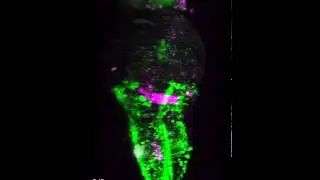 3D visualization of hindbrain-spinal circuit in larval zebrafish