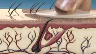 Using the Clearista Retexturizing Gel - Animation