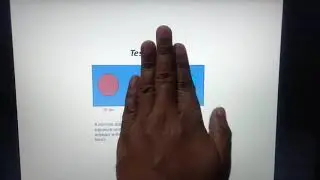 Testing dose of UVR
