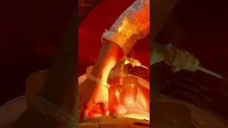 #back#pain#knee#pain#trending#audio#shoulder#pain#trending#shorts# #music #beats #slowedandreverb #