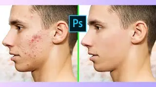 How to Photo Noise and Bron Remove in Photoshop। Photo Noise Remove in Photoshop।2023