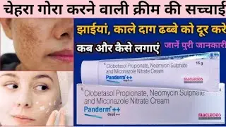 Panderm Plus Plus Cream Review | panderm plus plus cream ke fayde