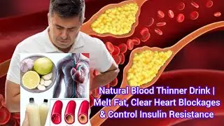 Natural Blood Thinner Drink | Melt Fat, Clear Heart Blockages & Control Insulin Resistance #detox 