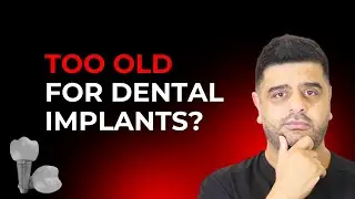 &ldquo;Am I too old for dental implants?&rdquo; 🤔 | The Missing Teeth Show