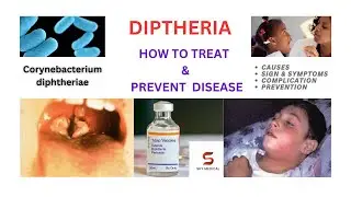 DIPHTHERIA خناق causes sign & symptoms, prevention &treatment  #diphtheria#vaccination #tdap #penta
