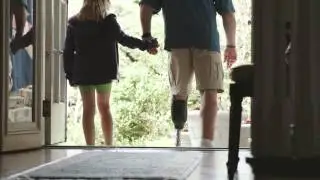 Keith's Amputee Story
