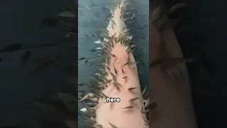 Have you ever tried fish therapy?