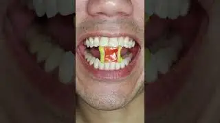 ASMR | Watermelon🍉Flavour | BOOMER Jelly Bubble Gum #doctortristanpeh #asmr #shorts #asmrsounds