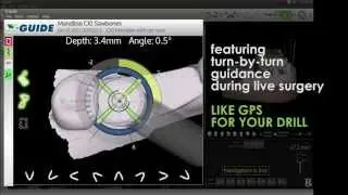 Intro Demo for the X-Guide Dynamic 3D Navigation System