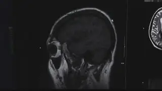 Sexual Assault brain damage research