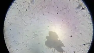 A single vorticella (?) observed through a terrible homemade microscope