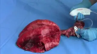 Ventrain pig lung and animation
