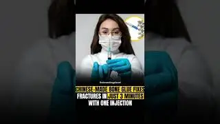 China Unveils Revolutionary &lsquo;Bone Glue&rsquo; That Heals Fractures in Minutes