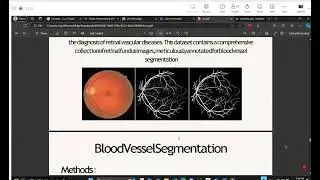 Graduation project [1]: Retinal Diseases Diagnosis