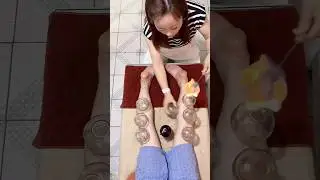 E40 Traditional cupping therapy 😃😄for body regulation.