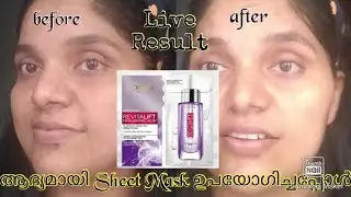 തിളങ്ങുന്ന മുഖം 15 മിനുട്ടിനുള്ളിൽ/L'oreal Paris hyaluronic acid serum sheet mask review