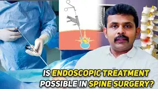 Is Endoscopic Treatment Possible in Spine&nbsp;Surgery? Dr. Vignesh Pushparaj