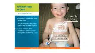 Central Lines Skills: Types of CVAD