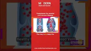 Treatments for Arterial and Venous Disease