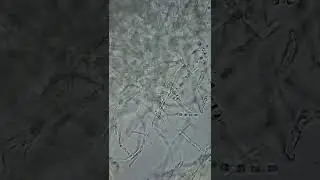 Micelio dicariotico di Pleurotus djamor al microscopio 🔬 🍄