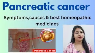 Pancreatic cancer treatment !! Pancreatic cancer symptoms,causes & homeopathic medicines !!