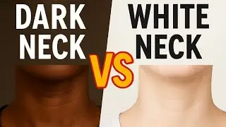 Dark neck Home Remedy Dark neck problem ?Try this remedy 
