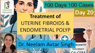 100 DAYS 100 CASES | DAY-20 | FIBROIDS & ENDOMETRIAL POLYP CASE | DR NEELAM AVTAR SINGH | VIDEO 192