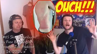 Skin Problems & Sunburns  FBE Teacher Talk Podcast #65 (Full Episode)