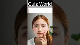 चेहरे पर पिंपल्स क्यों होते हैं? 🤔 | General Knowledge Quiz|#facts |#gk |#gkquiz |#quiz|#gkhindi