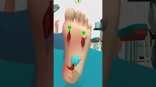 Foot Clinic ASMR Feet Care |Full video on description #gaming #shorts #asmr #shortfeed ##satisfying